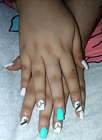 radical canción Estéril MIL ANUNCIOS.COM - Uñas gel Segunda mano y anuncios clasificados en Valladolid radical canción Estéril MIL ANUNCIOS.COM - Uñas gel Segunda mano y anuncios clasificados en Valladolid