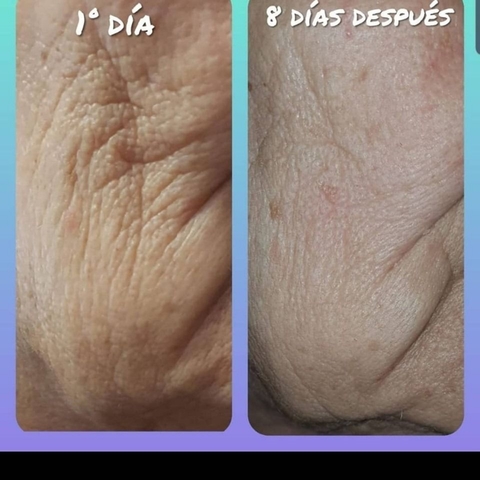 Mil Anuncios Com Crema Quemaduras Segunda Mano Y Anuncios